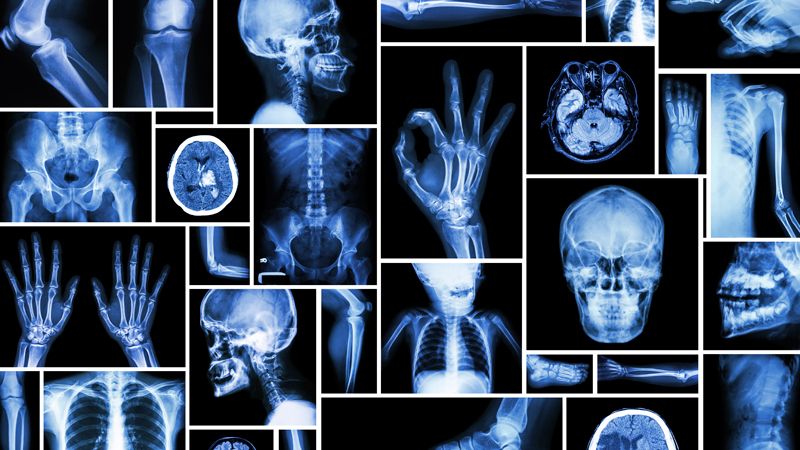 Is it safe to buy essays online x ray