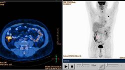 Nuclear Medicine – Virtual Information Session
