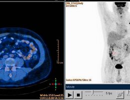 Register for a Nuclear Medicine Program Information Session